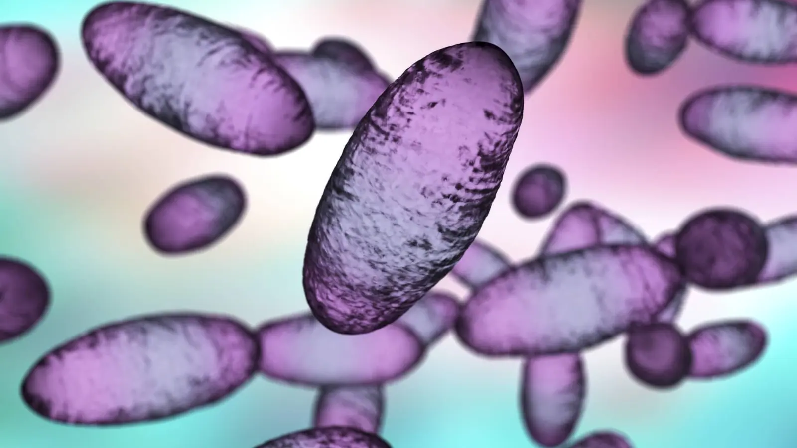 Russia plague: What we know about the suspected case reportedly linked to a lab worker’s death